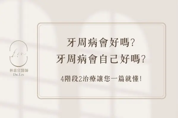 牙周病會好嗎？牙周病會自己好嗎？4階段2治療讓您一篇就懂！