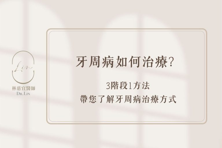 牙周病如何治療？3階段1方法帶您了解牙周病治療方式