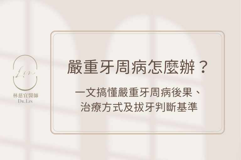 嚴重牙周病怎麼辦？一文搞懂嚴重牙周病後果、治療方式及拔牙判斷基準